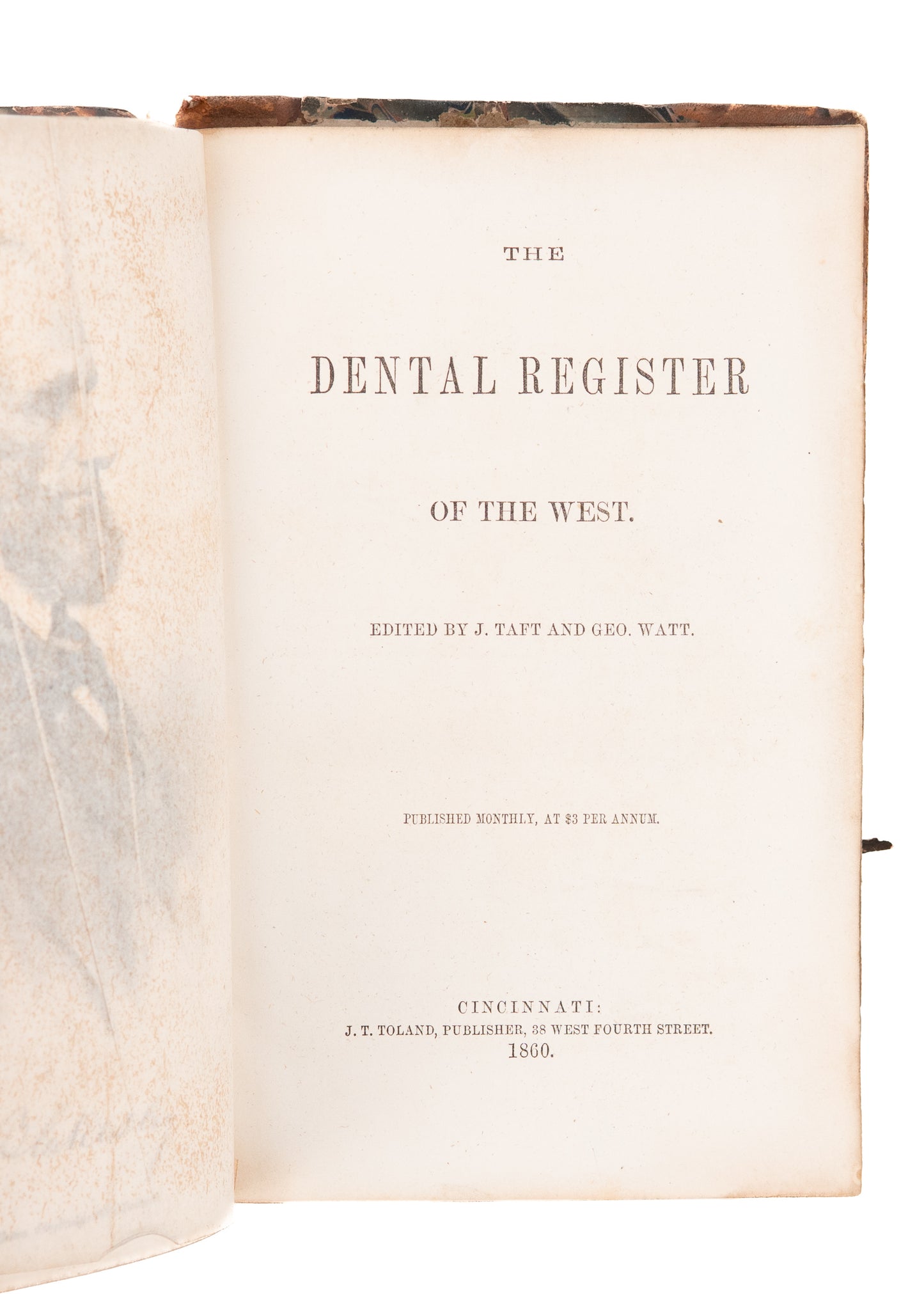1860 DENTISTRY IN WILD WEST. Dentures Swallowed, Oral Surgery on "Negroes," Chloroform Deaths.