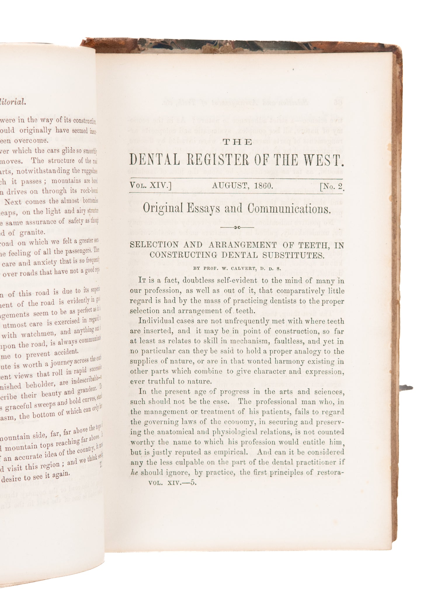 1860 DENTISTRY IN WILD WEST. Dentures Swallowed, Oral Surgery on "Negroes," Chloroform Deaths.