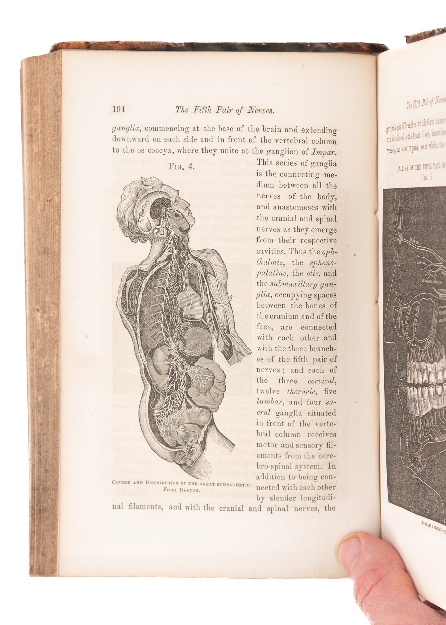 1860 DENTISTRY IN WILD WEST. Dentures Swallowed, Oral Surgery on "Negroes," Chloroform Deaths.