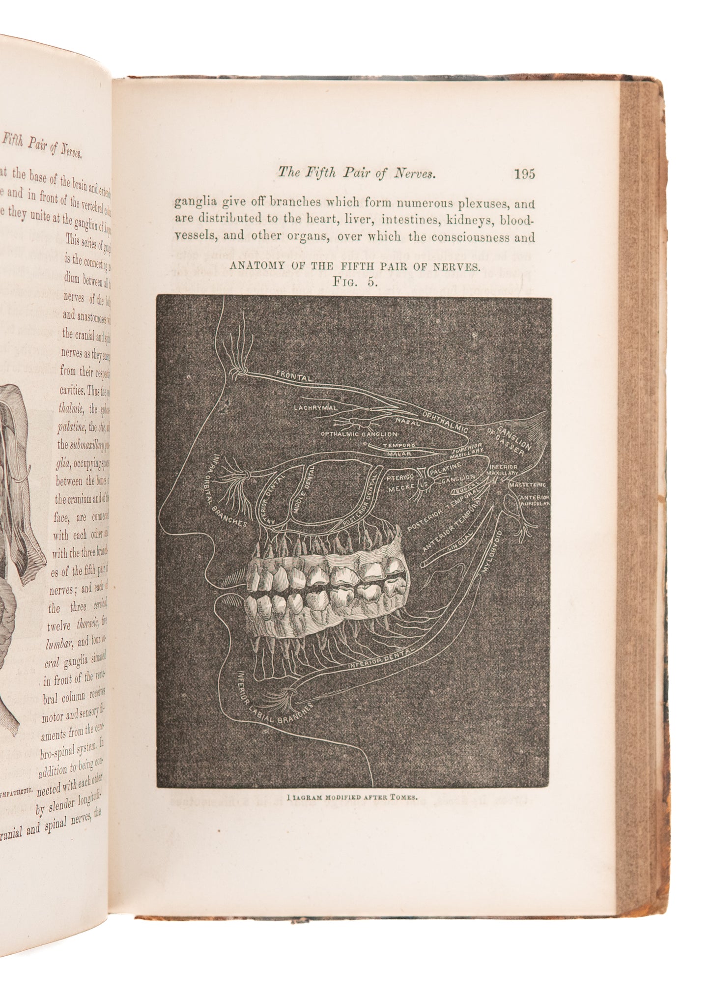 1860 DENTISTRY IN WILD WEST. Dentures Swallowed, Oral Surgery on "Negroes," Chloroform Deaths.