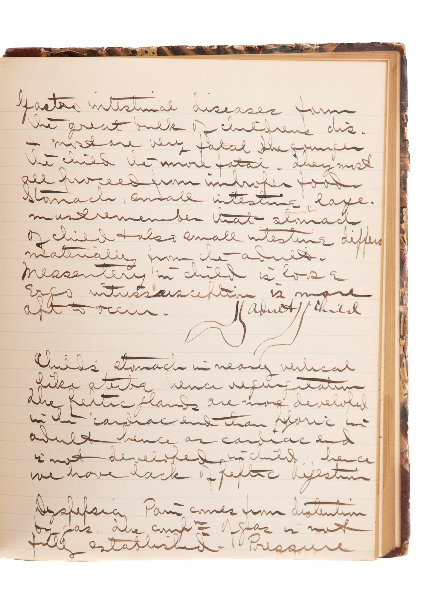 1882 MEDICAL MANUSCRIPT. Unpublished "Interesting Surgical Cases at the Rhode Island Hospital"