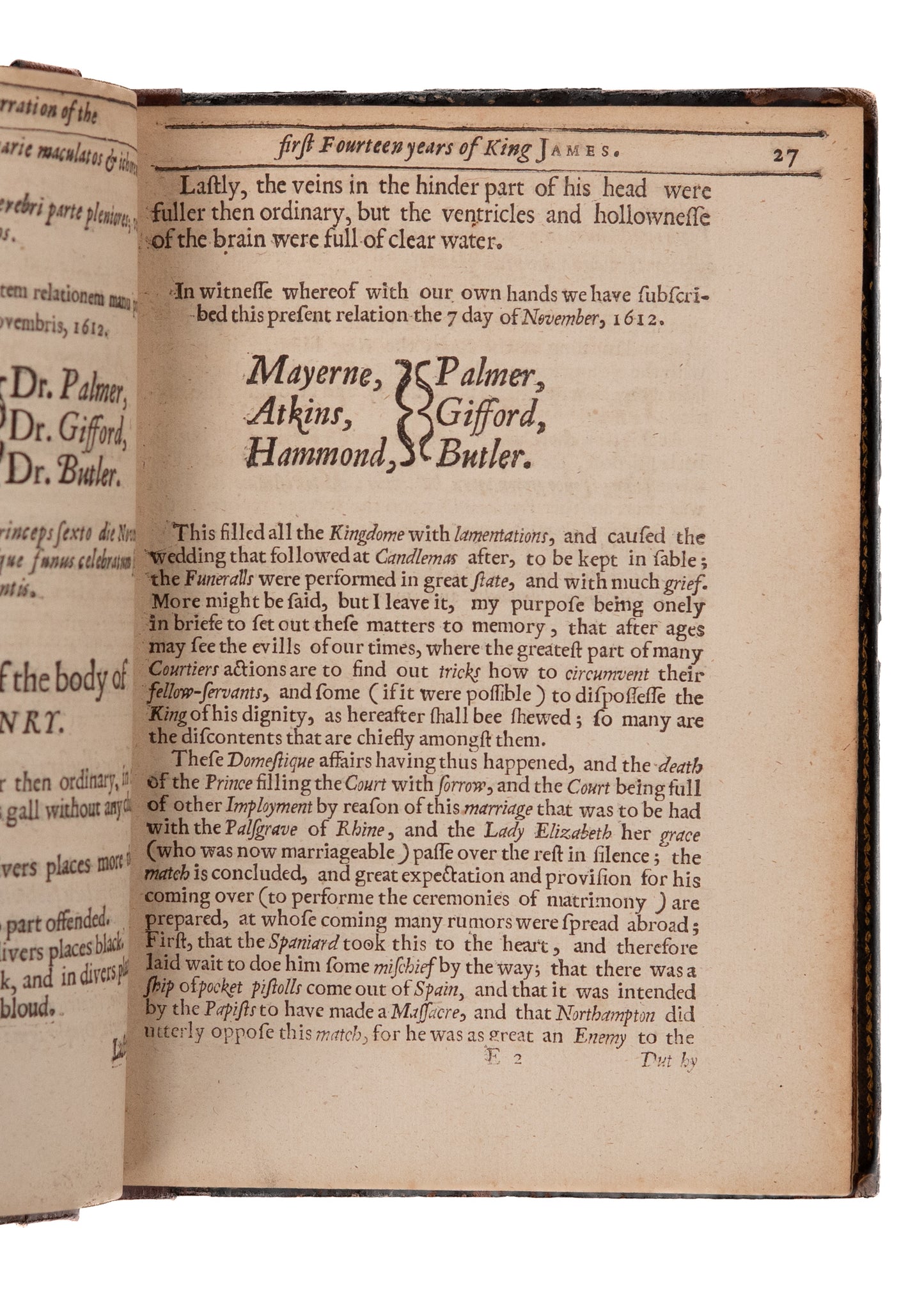 1651 KING JAMES. History of King James, His Financial Pilfering & the Burning of Heretics,
