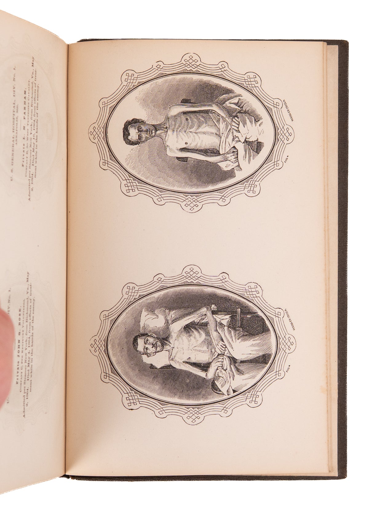 1864 CIVIL WAR. War Crimes of the Confederacy Against "Colored Troops." Gruesome Illustrations.
