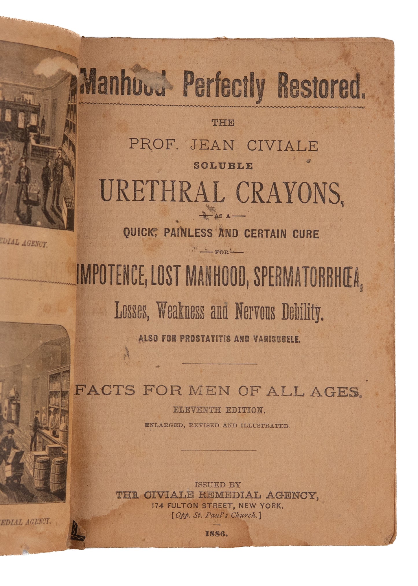 1886 URETHRAL CRAYONS. Manhood Restored! Before the Blue Pill, Behold, the Little Blue Crayon!