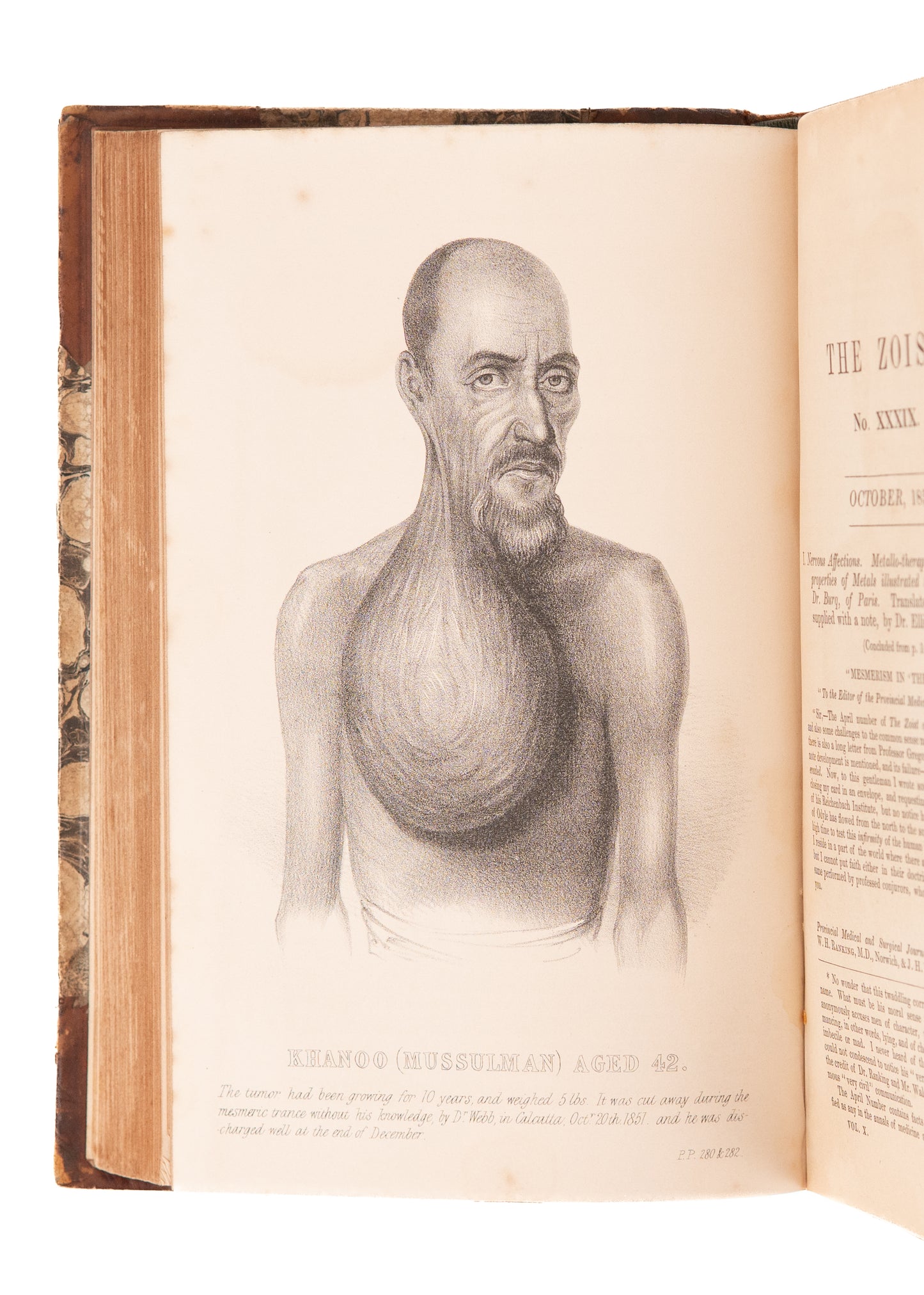 1852-1854 MESMERISM & CLAIRVOYANCE. Two Complete Years of "The Zoist" on Medical Mesmerism