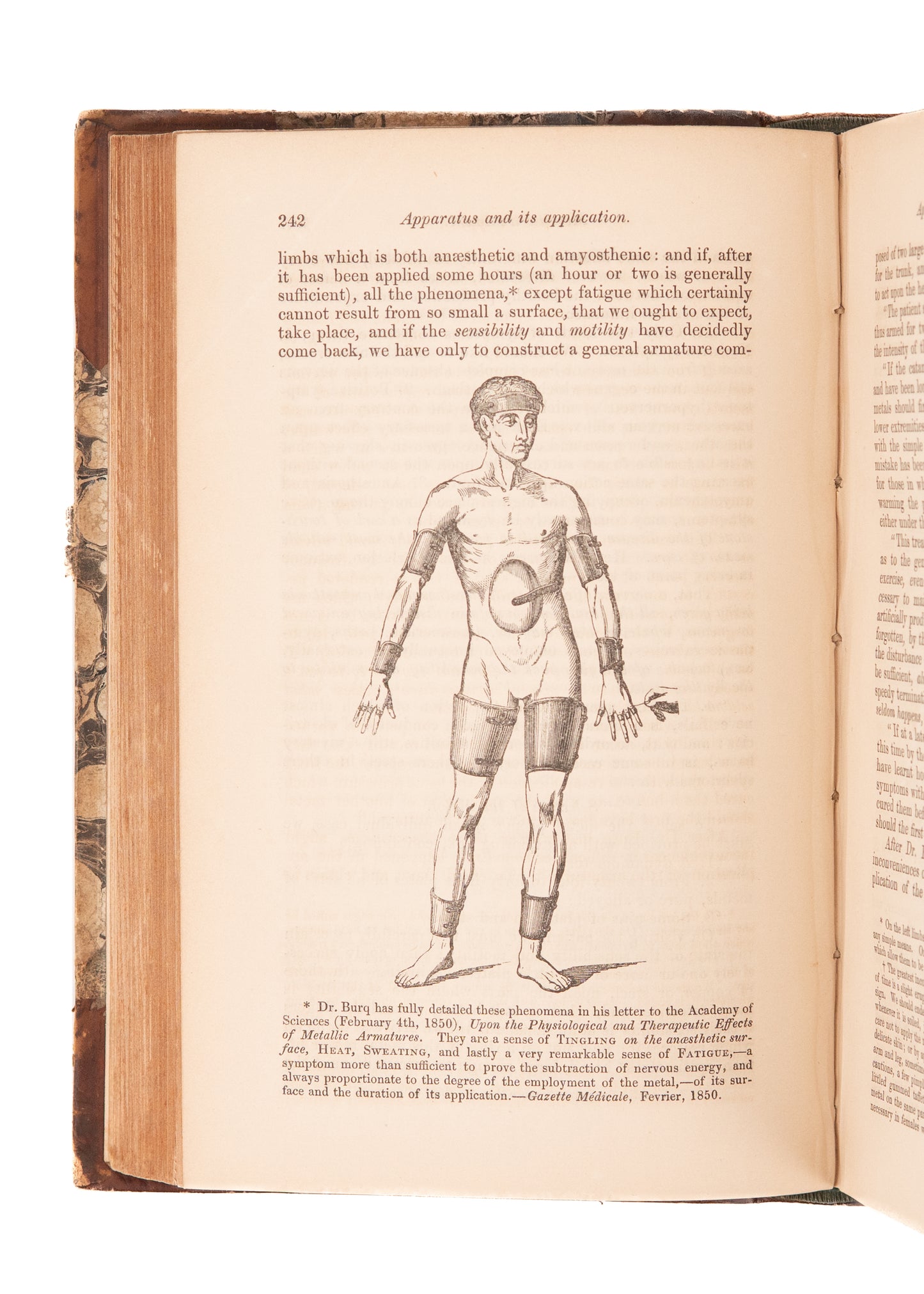 1852-1854 MESMERISM & CLAIRVOYANCE. Two Complete Years of "The Zoist" on Medical Mesmerism