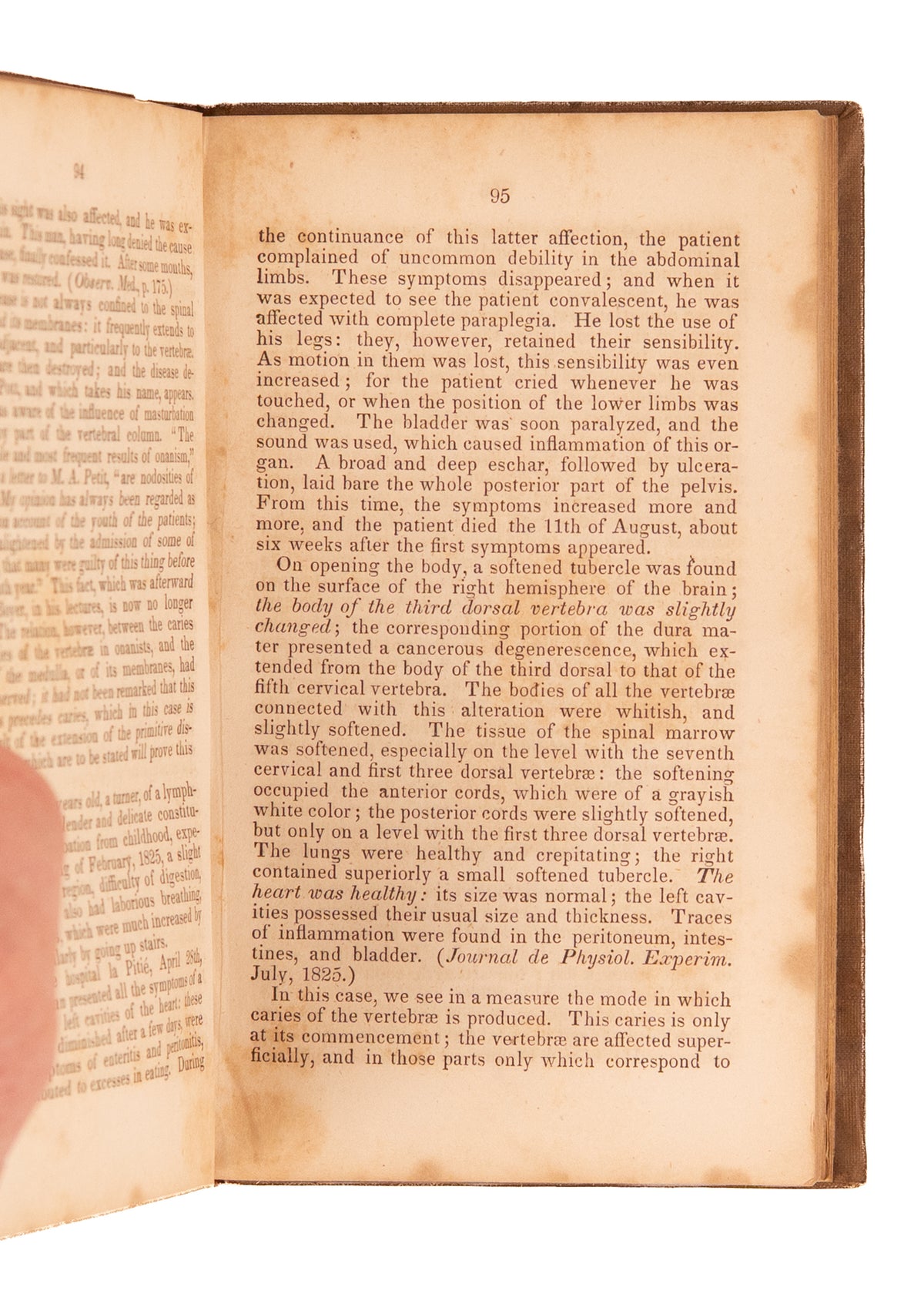 1839 EVILS OF ONANISM. Self-Pollution and Masturbation Lead to Mania, Depression, Suicide, and Crime.
