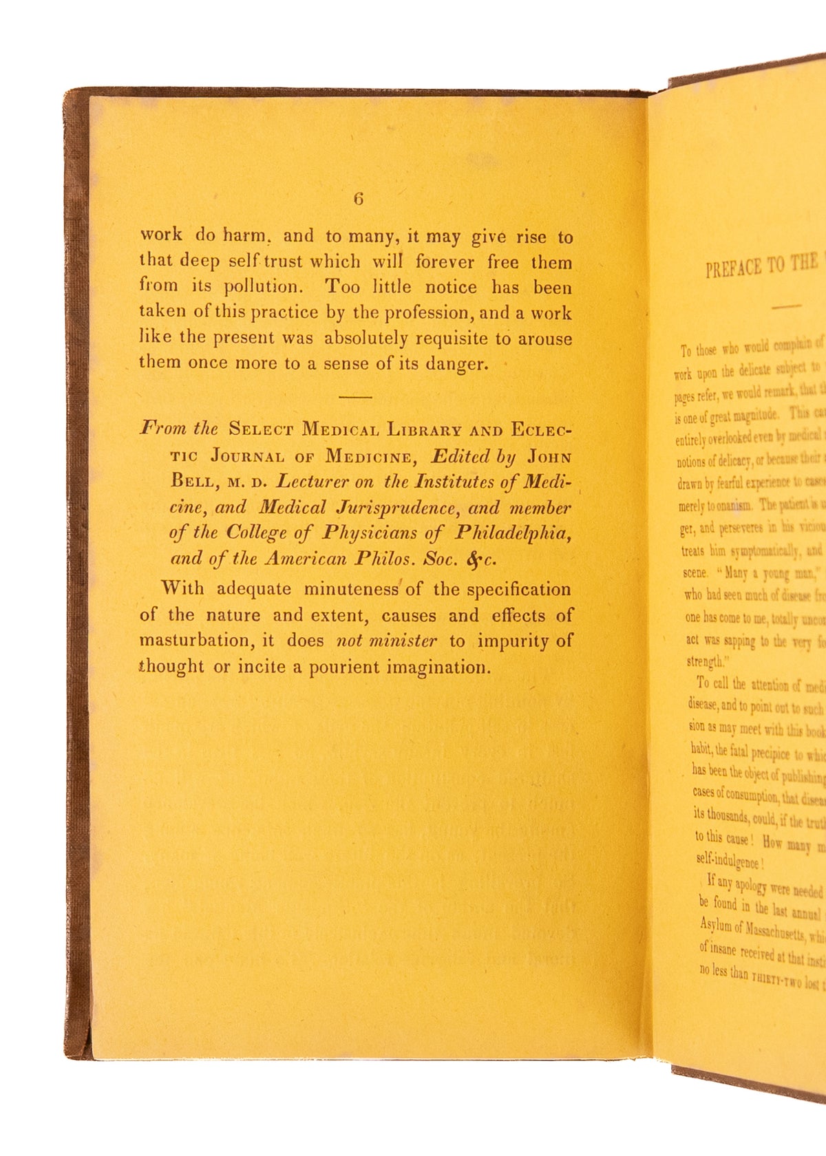 1839 EVILS OF ONANISM. Self-Pollution and Masturbation Lead to Mania, Depression, Suicide, and Crime.