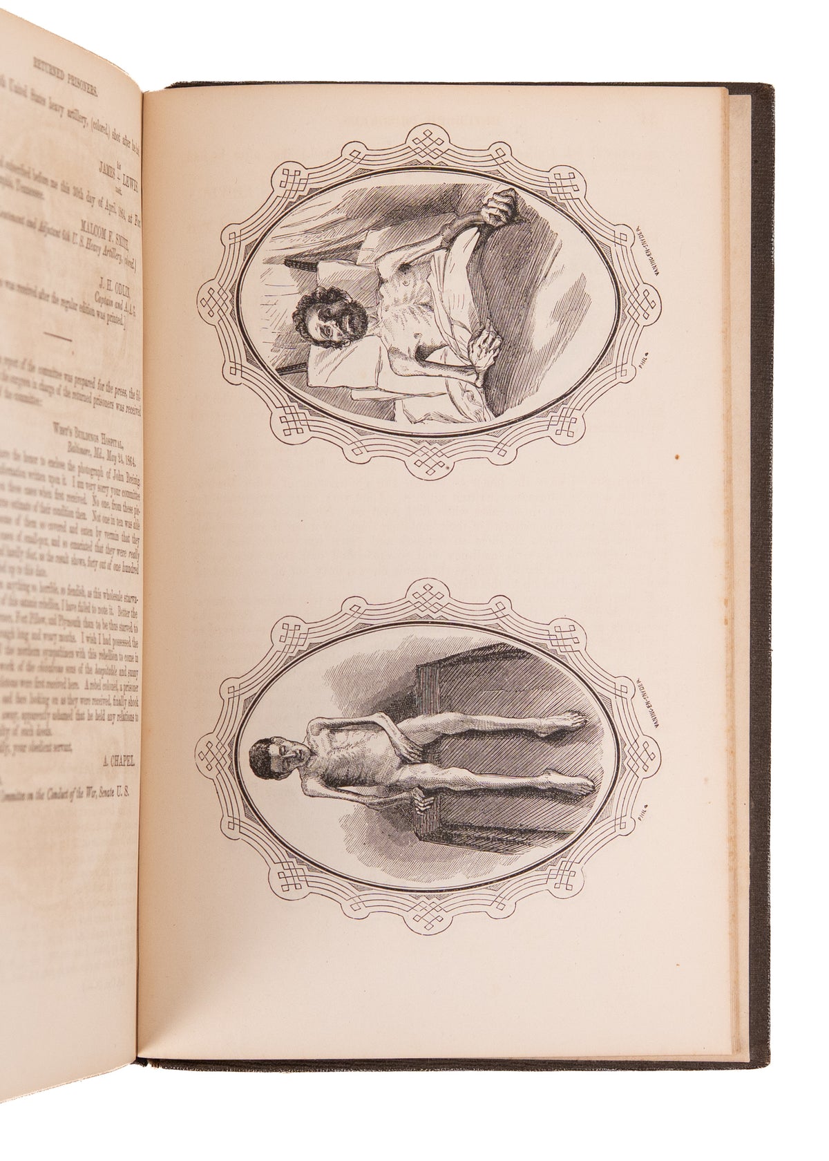 1864 CIVIL WAR. War Crimes of the Confederacy Against "Colored Troops." Gruesome Illustrations.