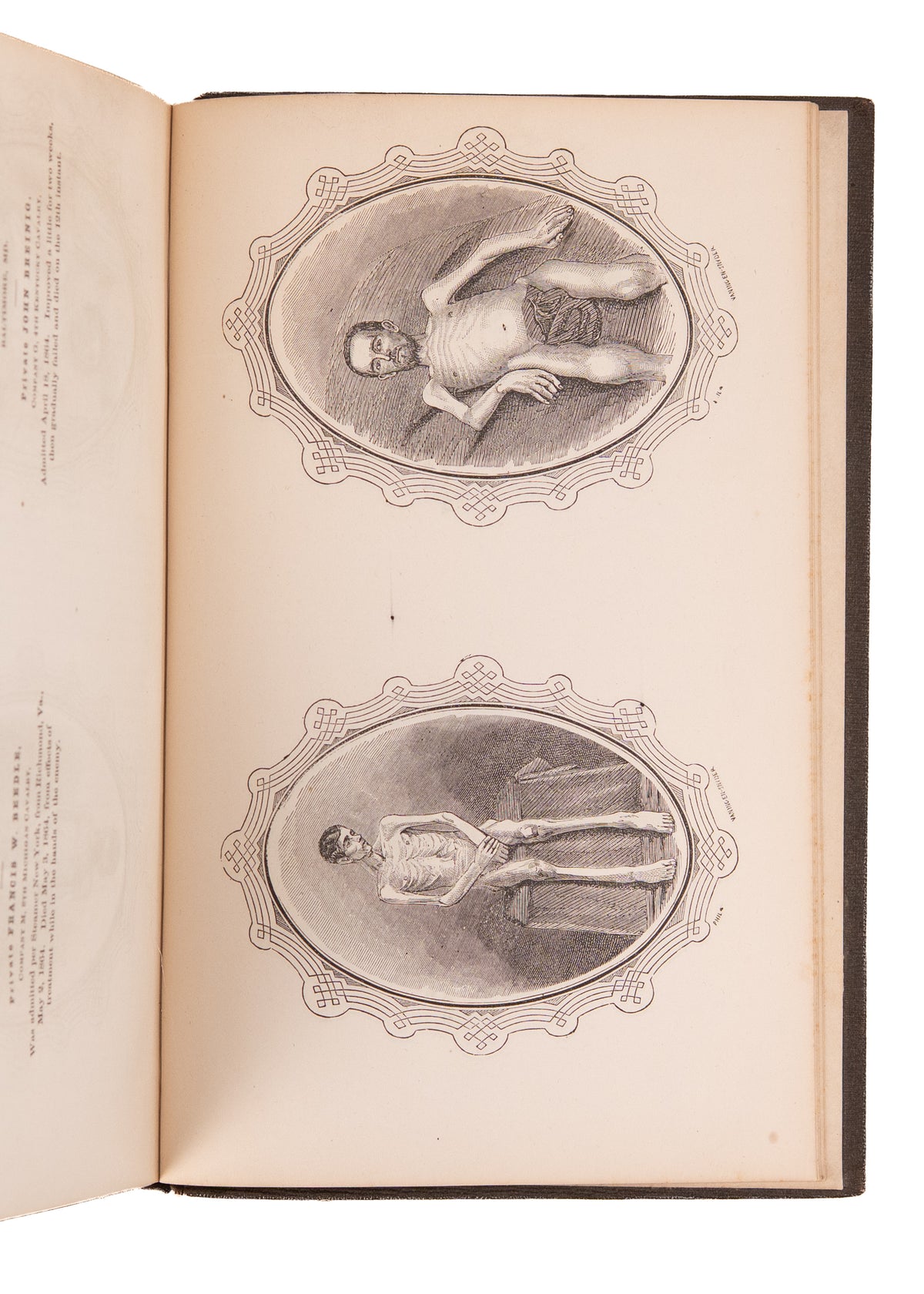 1864 CIVIL WAR. War Crimes of the Confederacy Against "Colored Troops." Gruesome Illustrations.